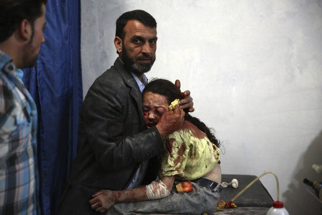 Foto la serie ganadora del segundo premio de 'Temas de actualidad'. La fotografía muestra a un niña siria herida que espera abrazada a su padre a ser atendida en un hospital en la ciudad de Douma (Siria) el 11 de mayo de 2015.