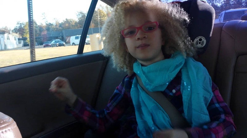 Ava Clarke, la niña negra albina que enamora en la red