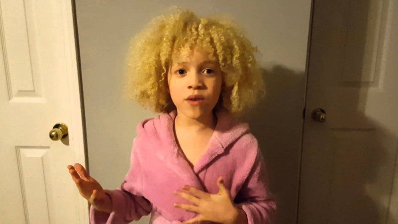 Ava Clarke, la niña negra albina que enamora en la red