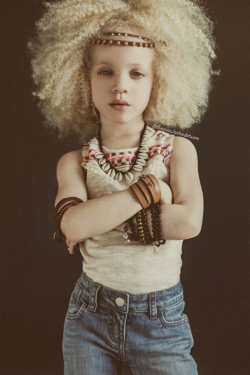 Ava Clarke, la niña negra albina que enamora en la red
