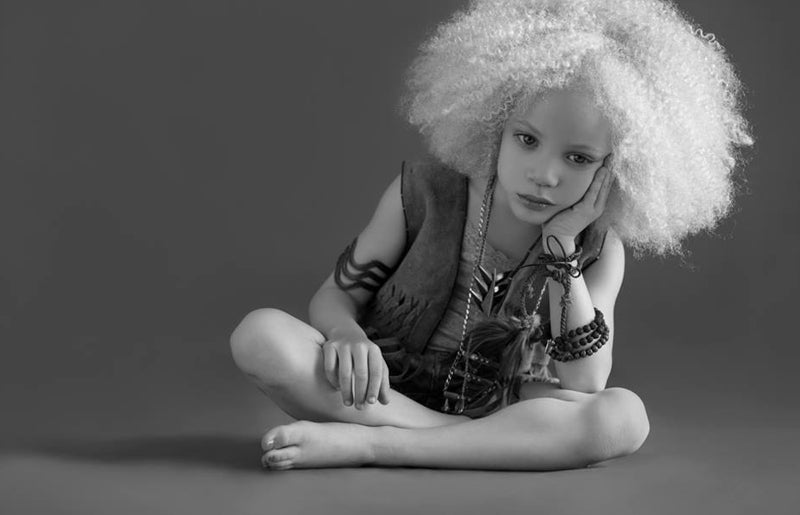 Ava Clarke, la niña negra albina que enamora en la red