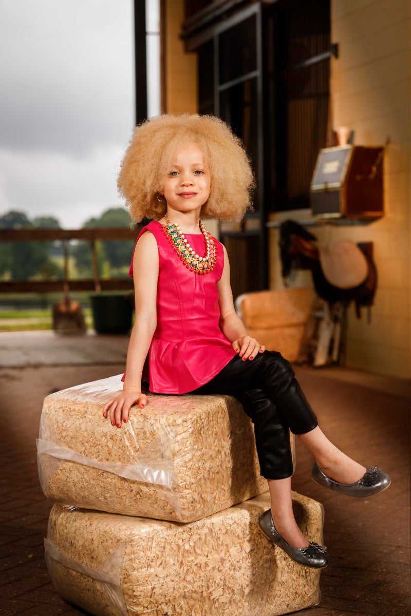 Ava Clarke, la niña negra albina que enamora en la red