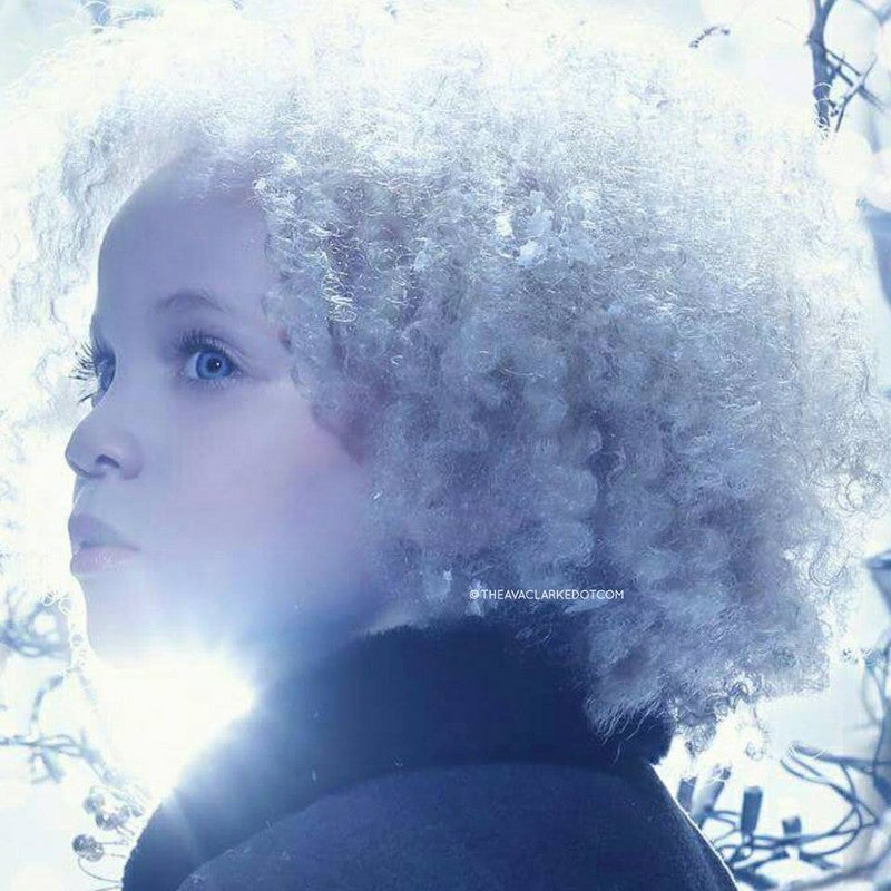Ava Clarke, la niña negra albina que enamora en la red
