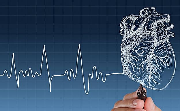 Dibujo de electocardiograma.