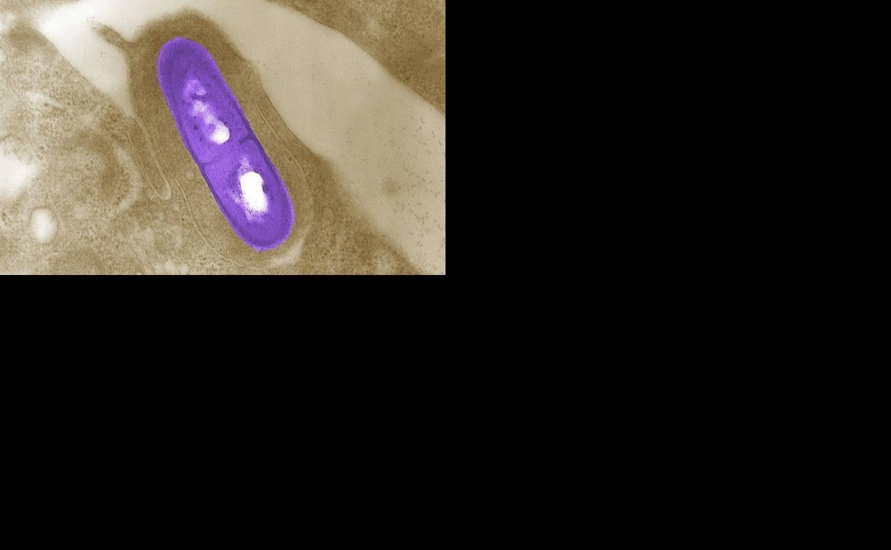 ¿Qué es y cómo se diagnostica la listeriosis? ¿Cómo se transmite? ¿Qué alimentos pueden producir? Guía de preguntas y respuestas sobre la enfermedad