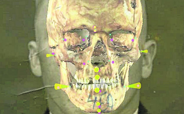 Superposición del cráneo sobre la fotografía según la posición de los 'landmarks'.