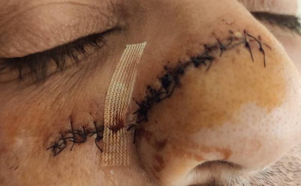 Imagen principal - «Pese a la cicatriz y a las operaciones, volvería a mediar en la pelea; para eso soy policía local»
