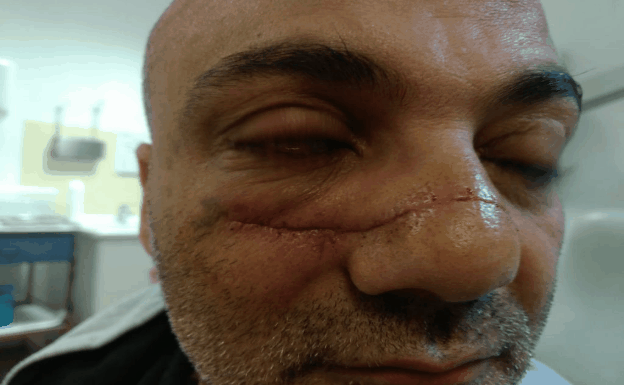 «Pese a la cicatriz y a las operaciones, volvería a mediar en la pelea; para eso soy policía local»
