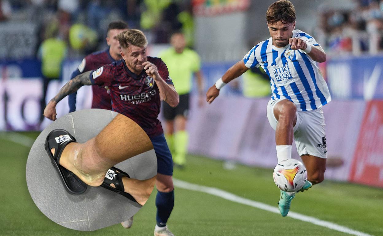 El jugador del Málaga, Kevin Medina, en una jugada en el partido contra el Huesca. En el círculo, imagen de la inflamación del tobillo de Kevin tras el partido.