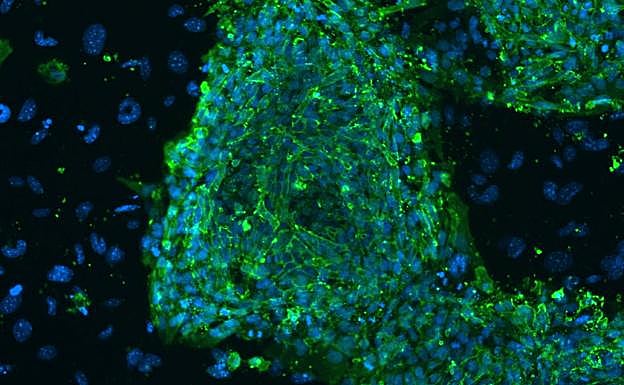 Imagen de archivo de células madre embrionarias humanas vistas a través de la imagen fluorescente de un microscopio. 
