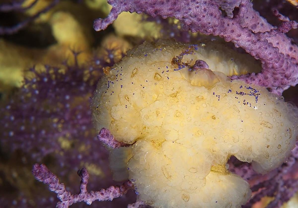 El mieloma múltiple es un tipo de cáncer de la sangre que se considera crónico.