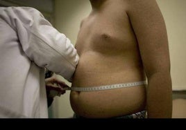 El SAS atiende cada año a más de 462.600 andaluces con problemas de obesidad