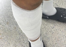 Un árbitro de fútbol sala denuncia que un jugador le lanzó un banquillo y lo lesionó