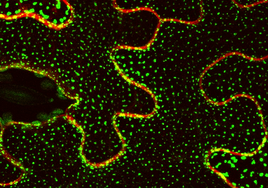 Imagen al microscopio de la proteína Sinaptotagmina 1 unida a la proteína fluorescente GFP.