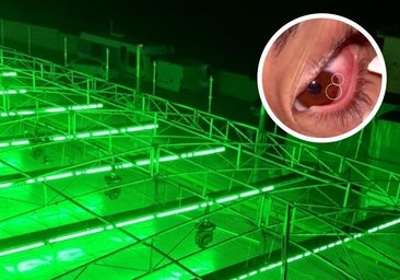 «Tienen metal en el ojo», afirman los padres de los menores afectados por la atracción de Valle de Abdalajís