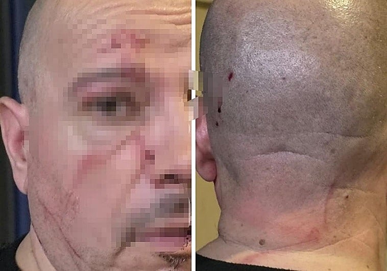 Encañonan y agreden a un vecino de Marbella de 61 años para atracarle: «¡Están matando a un hombre a golpes!»