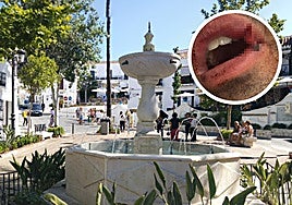 Lugar en el que ocurrieron los hechos y la lesión sufrida por la víctima.