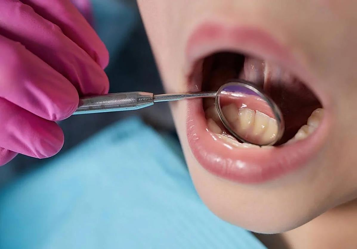 Revisiones dentales gratuitas: el SAS empieza a llamar para concertar las primeras citas