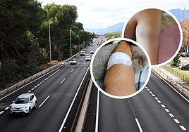 Imagen de la A-7 a su paso por Marbella con detalle de las lesiones en piernas y brazos de David