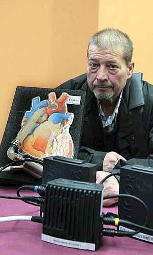Eufemio García, en la rueda de prensa posterior al transplante. / Alberto Estévez (Efe)