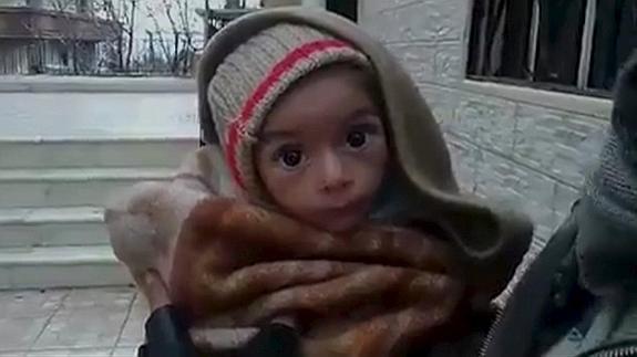 Fotografía de un niño desnutrido en la ciudad siria de Madaya. 