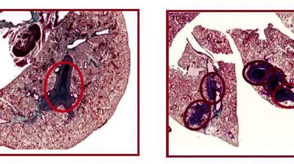 La ausencia de NCoR aumenta la formación de metástasis (rodeadas de círculos rojos). Izquierda: pulmones de ratones inyectados un mes antes con células de adenocarcinoma que expresan NcoR, o en las que se había eliminado este corepresor (derecha).