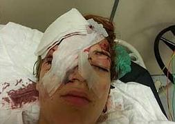Estado en el que quedó Nicole Zanlith tras la agresión. :: SUR