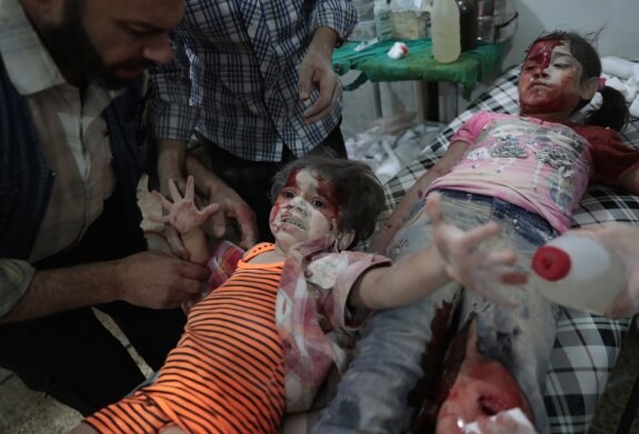 Dos niños heridos son atendidos en un hospital en Douma después de un bombardeo. :: A. D / AFP
