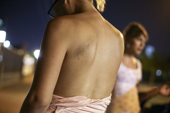Cristina muestra la herida que el ataque le dejó en la espalda. :: d. pérez