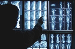 Todas las pruebas de imágenes del Clínico se verán en formato digital