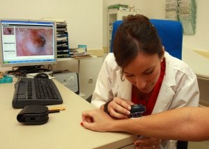 Un tercio de pacientes con melanoma no extreman la protección ante el sol