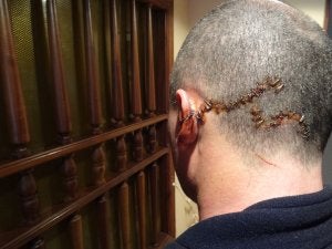 Le rompen tres botellas en la cabeza y le dan una puñalada por defender a unas amigas