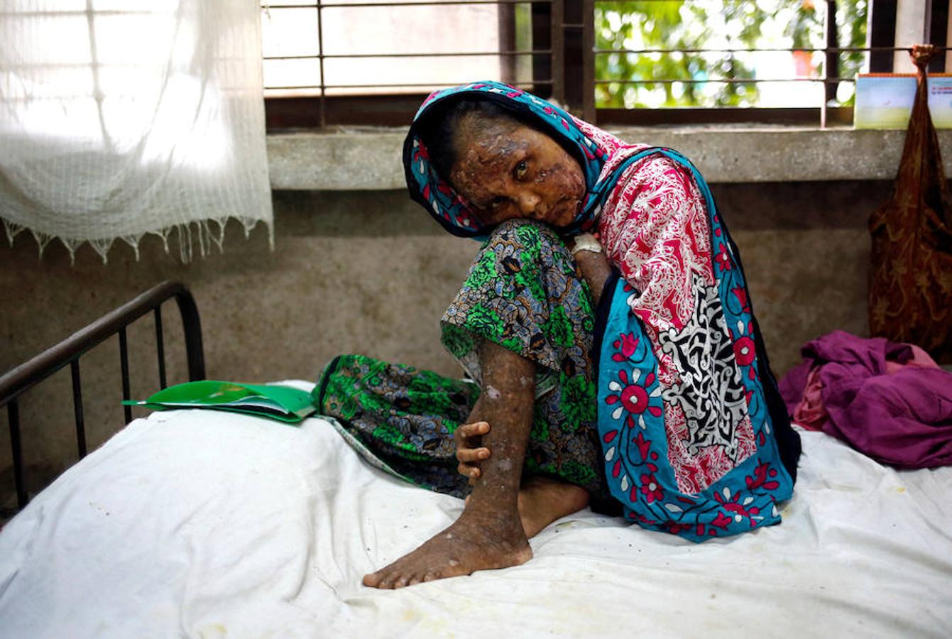 Más de 420.000 refugiados han llegado a Bangladés huyendo de la persecución por parte del ejércido de Myanmar sumergidos en el hambre, las enfermedades y la violencia. Son los rohinyá, una minoria musulmana que pertenece a un país de mayoria budista. La mayor parte de los refugiados son niños que llegan desacompañados y mujeres.