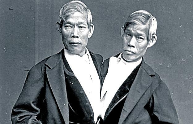 Los siameses Chang y Eng llegaron al mundo en 1811 y siguieron juntos hasta el final.
