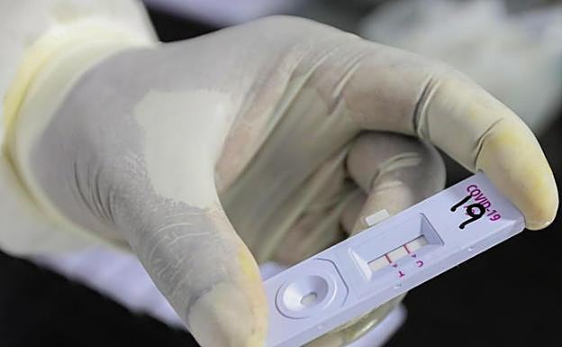 Sanidad dará luz verde la próxima semana a las pruebas de autodiagnóstico de covid