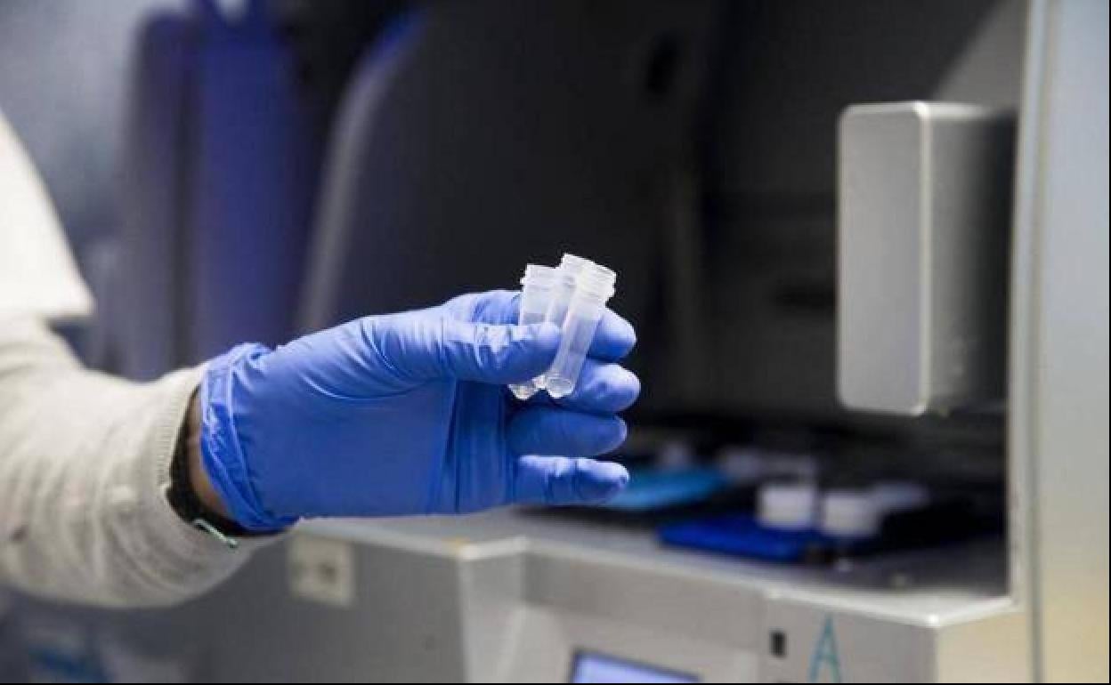 En Euskadi hay confirmados cuatro casos de viruela del mono.