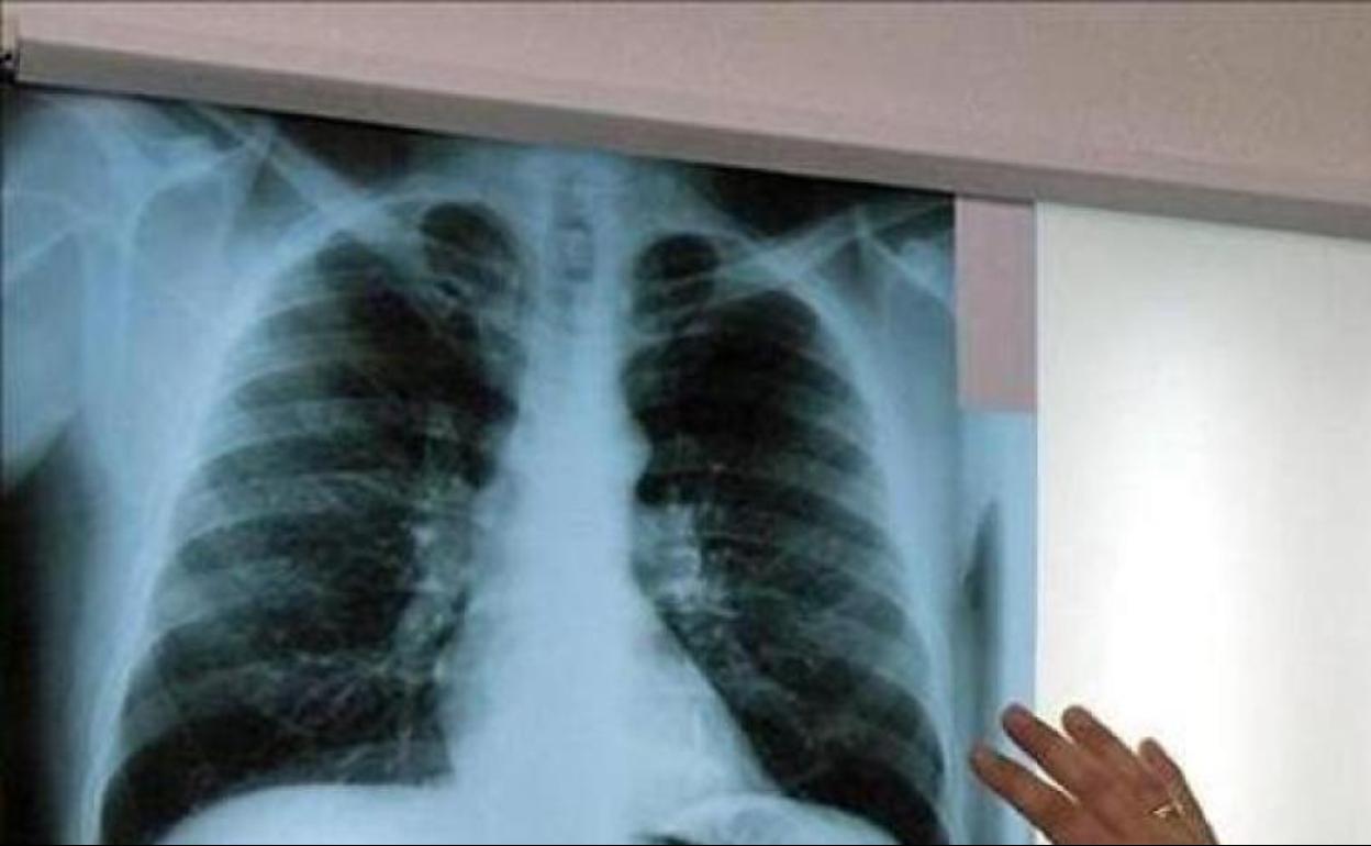 La familia de un fallecido por asbestosis pulmonar tras trabajar con amianto en CAF reclama 148.311 euros