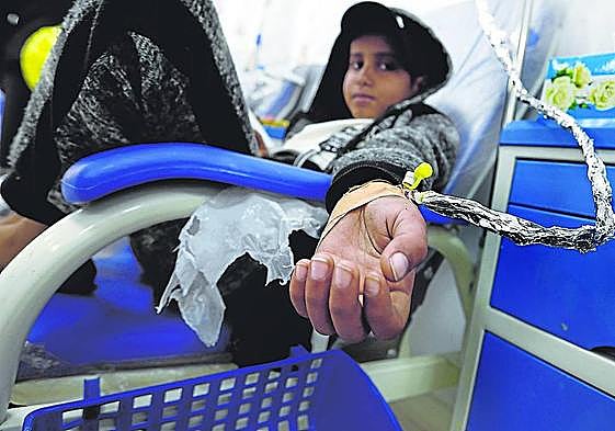 Un niño con leucemia se somete a tratamiento médico.