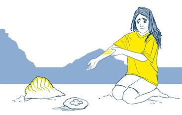 Qué hacer si te pica una medusa