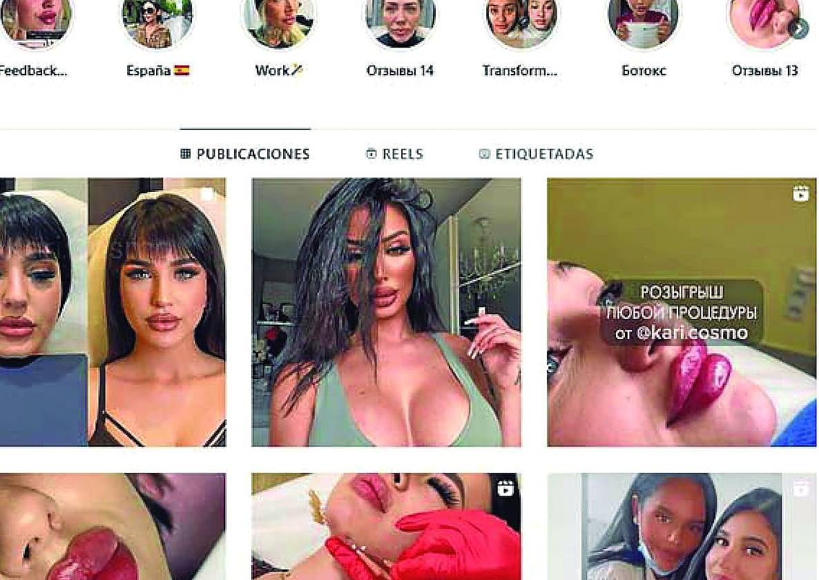 Pantallazo de la cuenta de Instagram de la supuesta cosmetóloga rusa que aportó el Colegio de Médicos de Gipuzkoa en su denuncia.
