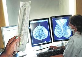 Semillas para luchar contra el cáncer de mama