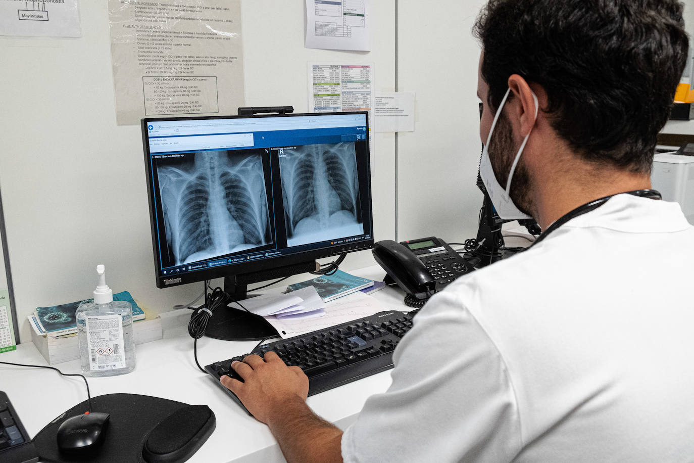 Un sanitario observa varias radiografías. 