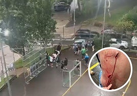 La agresión tuvo lugar en los alrededores del campo de fútbol de Bidebieta.