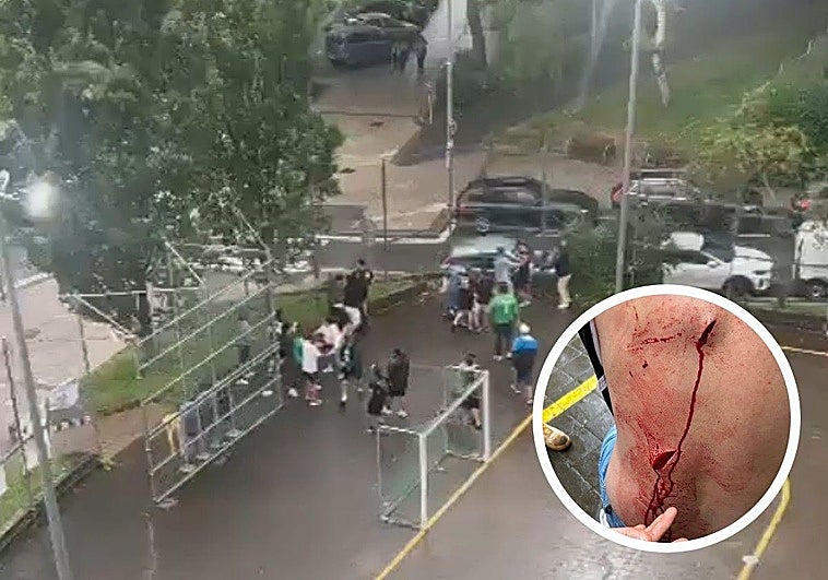 La agresión tuvo lugar en los alrededores del campo de fútbol de Bidebieta.