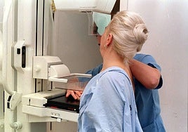 Una mujer es sometida a una mamografía en un hospital.