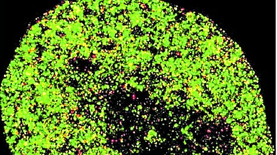 UPV y DIPC desarrollan una inteligencia artificial para detectar el cáncer y virus