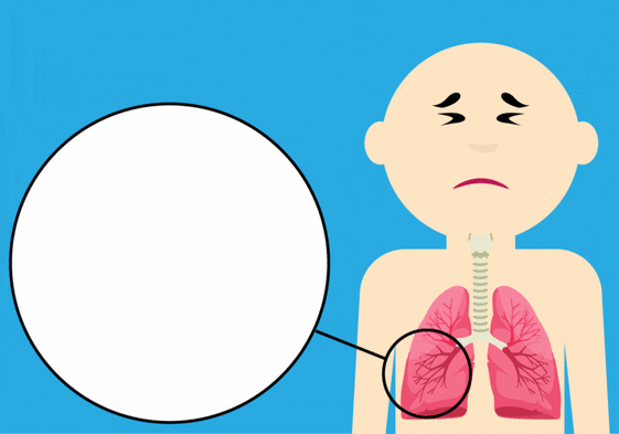 Arranca la vacunación contra la bronquiolitis en Euskadi: ¿Qué bebés conforman la población diana?