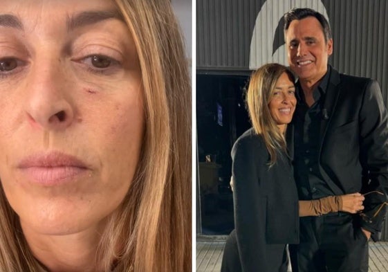 María Amores, mujer de Ion Aramendi, muestra la herida tras un percance con el aro de luz.