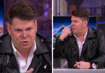 Lucas, de 'Andy y Lucas', se derrumba en 'El Hormiguero' al confesar su  operación de nariz: «No hice caso a los médicos» | El Diario Vasco