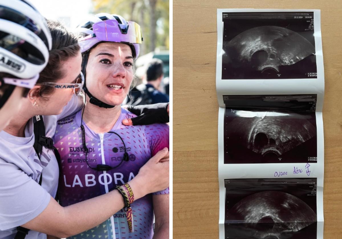 La ciclista guipuzcoana Ane Santesteban habla de su enfermedad: «Ahora sé que los resultados llegarán»